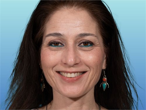 ליאורה חסידוב